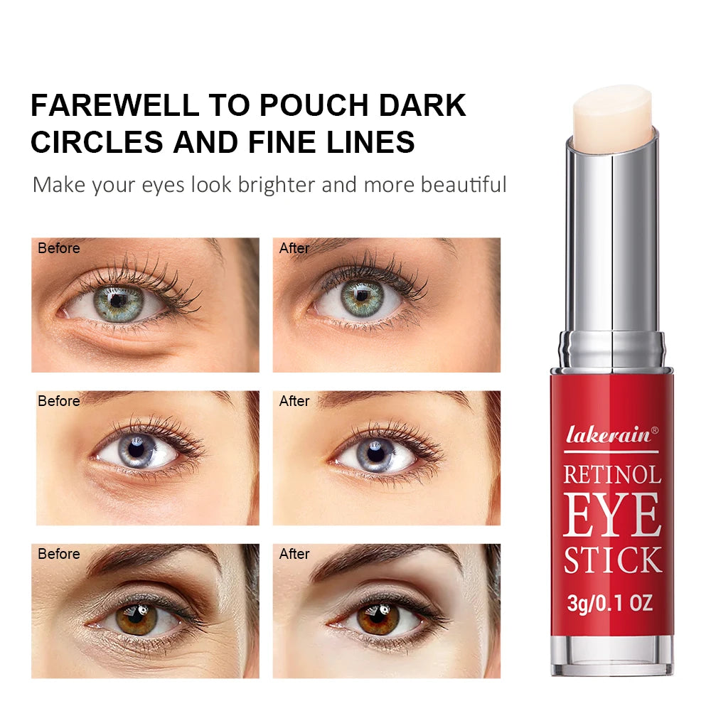 Retinol Firming Dark Circle Eye Cream